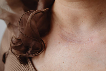 How Do Silicone Scar Sheets Work?