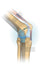 Backed by knee bracing research